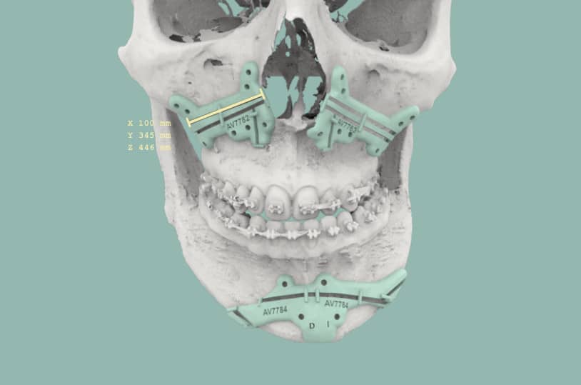 Diagnóstico Facial 3D